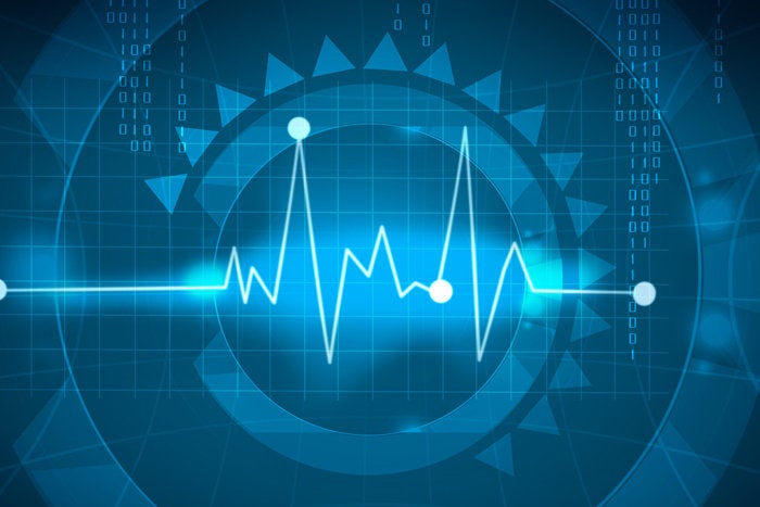 How to find and fix performance problems in PHP applications