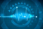 How to find and fix performance problems in PHP applications