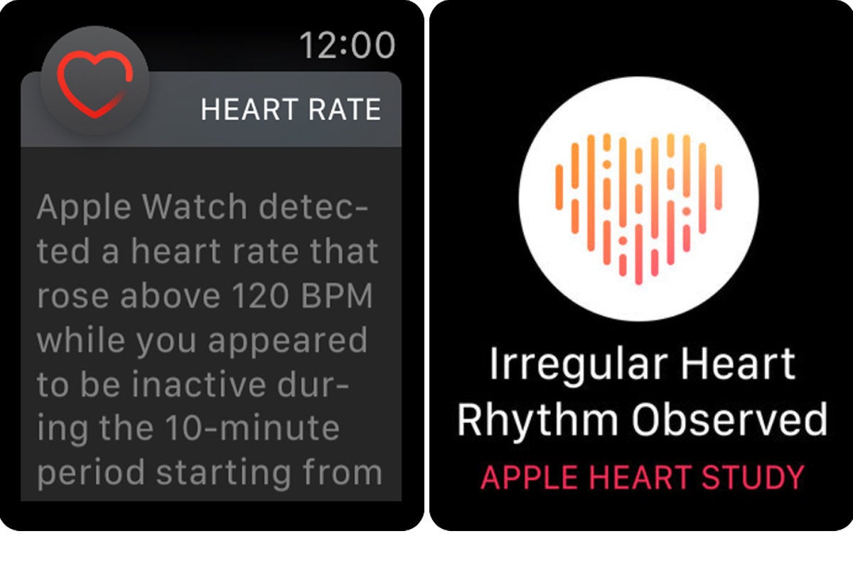 heart study apple watch