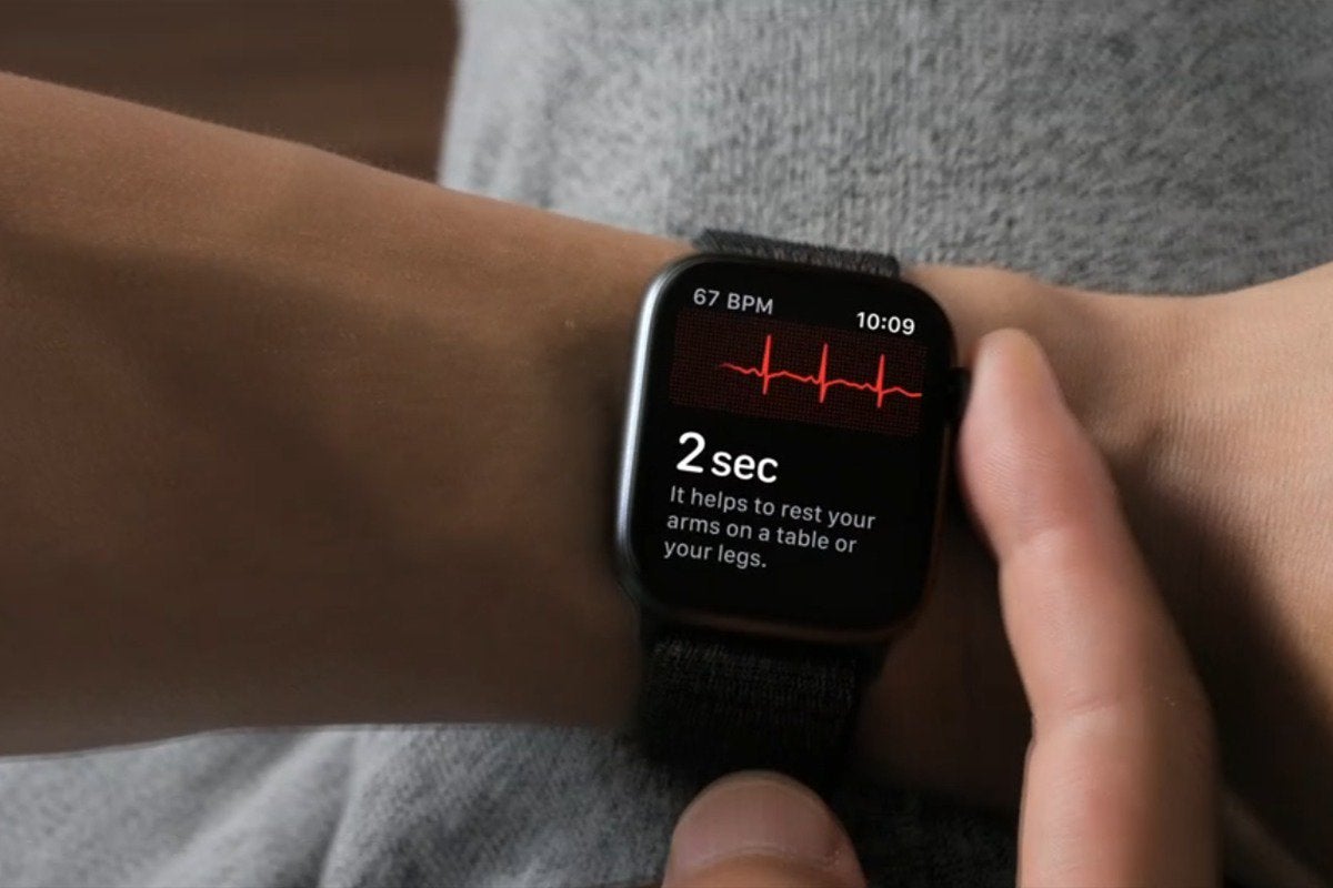 apple watch series 4 ecg