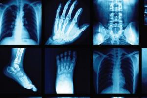 The New Radiology Assistant: Artificial Intelligence