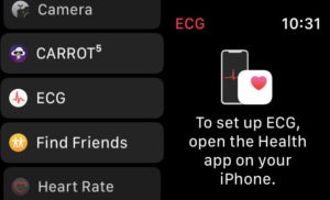 Apple Watch ECG 앱