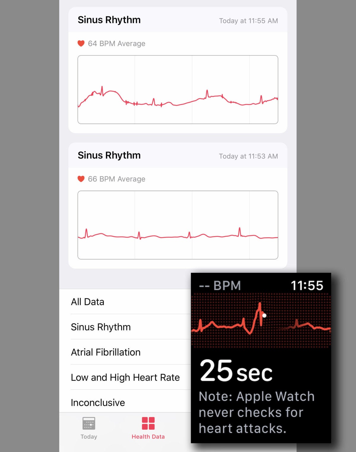 Το Apple Watch ECG ολοκληρώθηκε