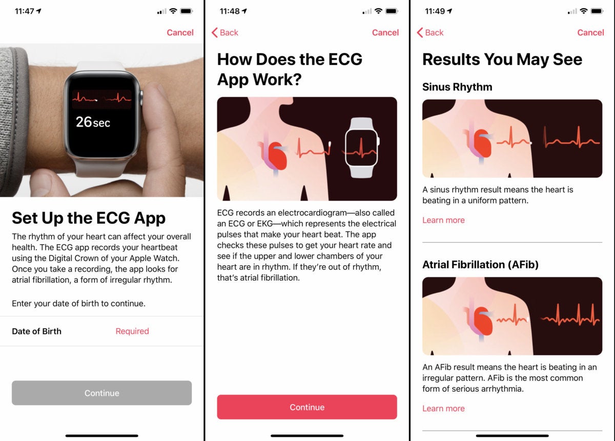 Take an ECG with the ECG app on Apple Watch - Apple Support