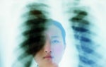 Artificial Intelligence Opens New Frontiers in Healthcare
