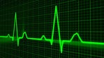 'AI everywhere' IoT chips coming from Arm