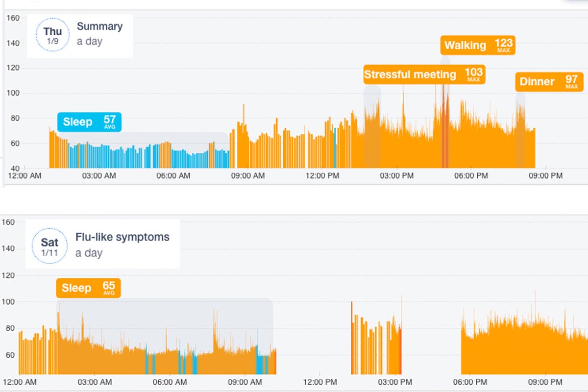 cardiogram heart rate sick